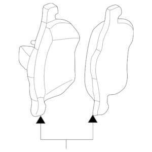 Volvo Brake Pad Kit 30793265